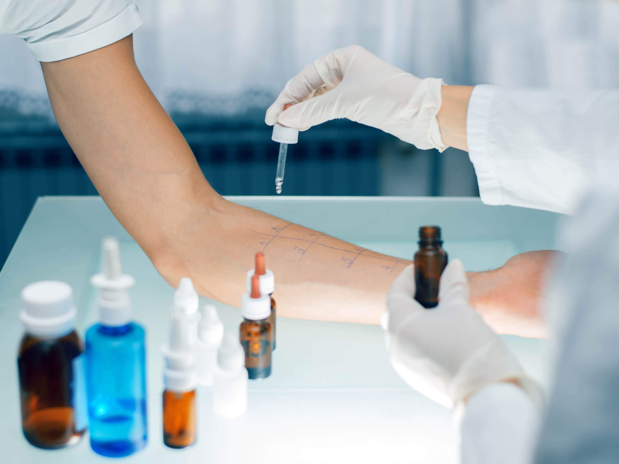 Coceira, vermelhidão, inchaço? Veja 5 tipos de alergias na pele e como tratá-las